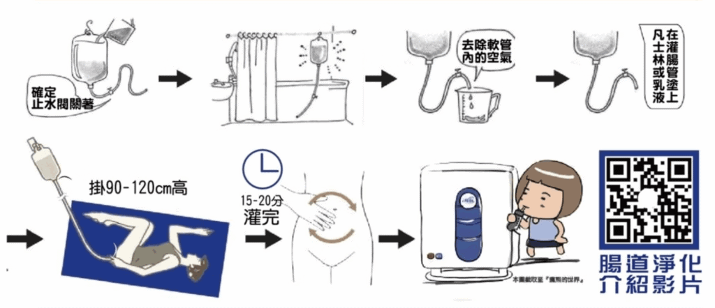 咖啡灌腸操作步驟圖解